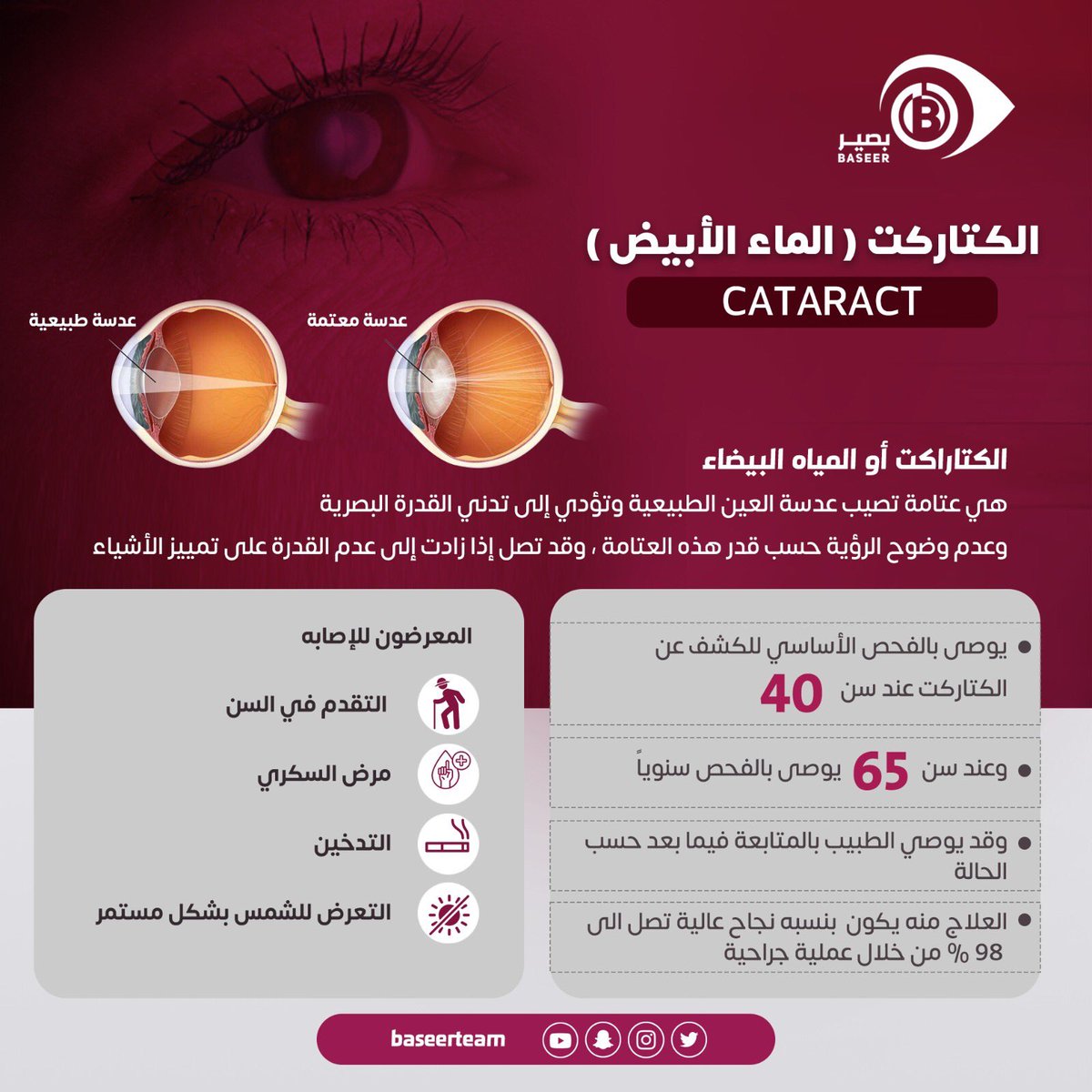 ⚠️⚠️⚠️

الساد (الماء الأبيض ) هو عتامة تُصيب عدسة العين وتحولها تدريجيا للون لأبيض مما يؤثر على صفاء الرؤية ..

 🔻🔻

<a href="/6abeb_/">#صوت_الطبيب🩺</a> 
#صوت_الطبيب