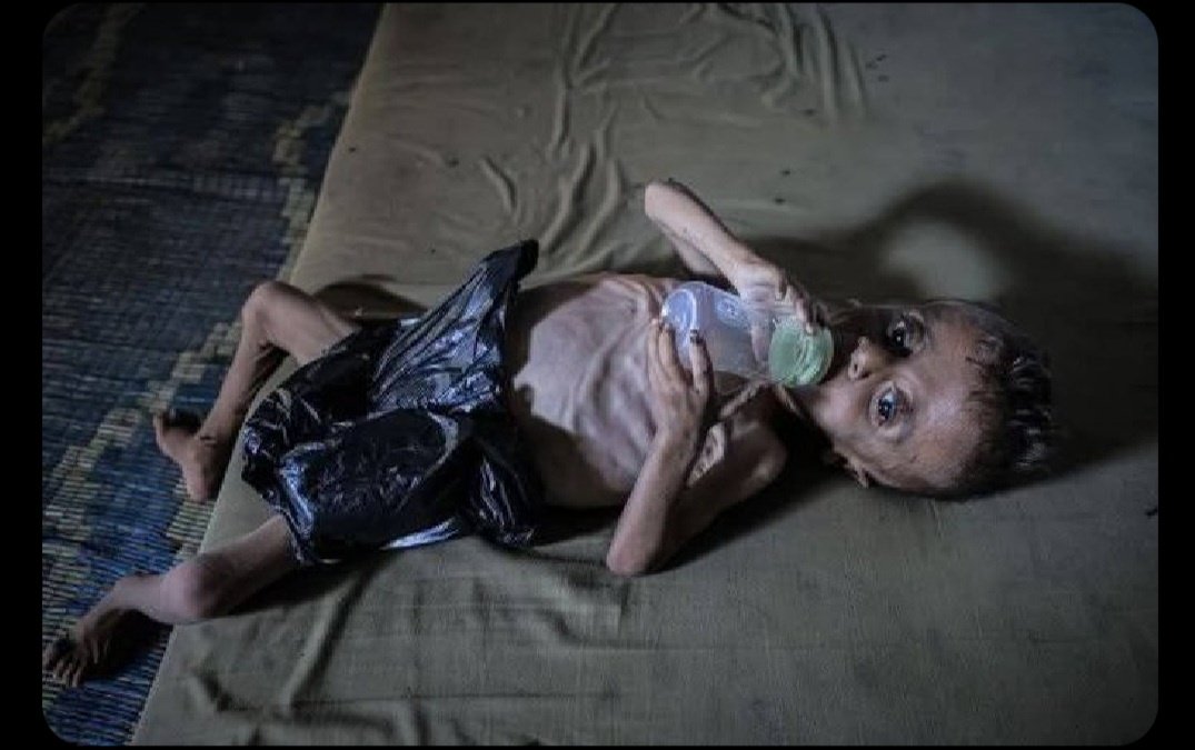 RomanovicJelena's tweet photo. @TomMayerEuropa Israel: Untersuchung zeigt, dass die Hamas die Hungerdaten im Gazastreifen in einer „orchestrierten Kampagne“ aufgebläht hat.
https://t.co/PKyZOSdI5A
Dieses Kind im Sudan wird für primitive, von allen Göttern verlassene, #hamasis - Propaganda missbraucht. https://t.co/RojMIUl7cL