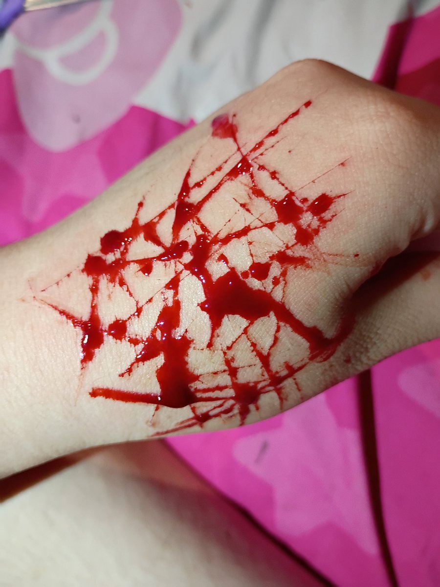 0verkilldoll's tweet photo. Γomiiiiii (β β§β β½β β¦β )
#shtwt #selharm https://t.co/GhRDy77uJu