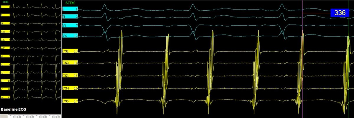 Giovanni Coluccia tweet media