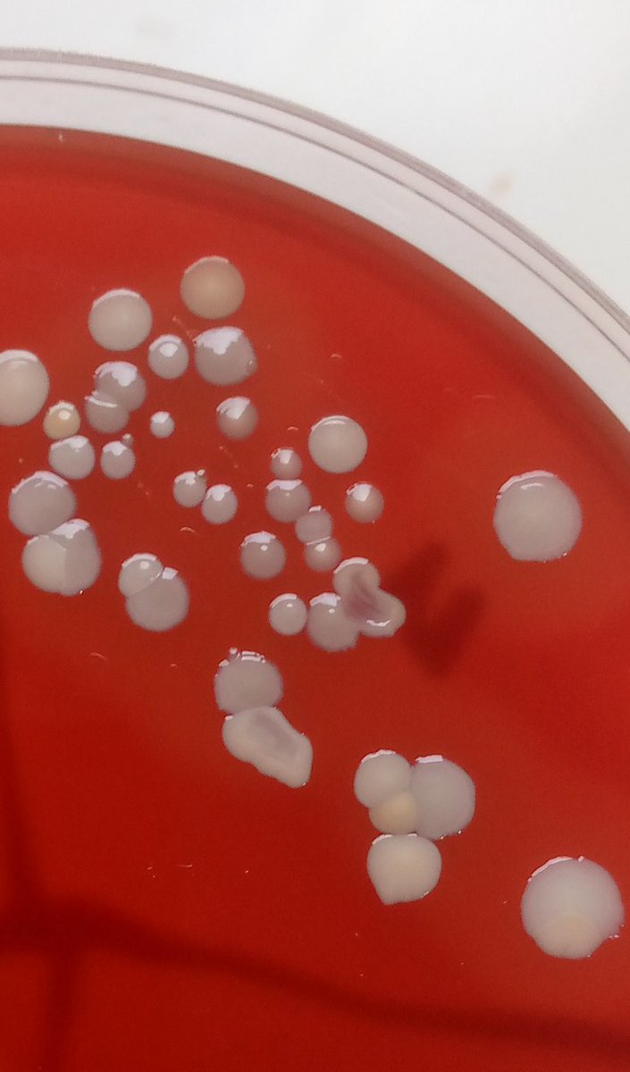 ShololaDamilol2's tweet image. From experience working with urogenital samples, I can tell that reproductive tract infections (RTIs) are already a significant public health concern in Nigeria. They contribute notably to both male and female infertility, as well as to a range of #reproductive complications