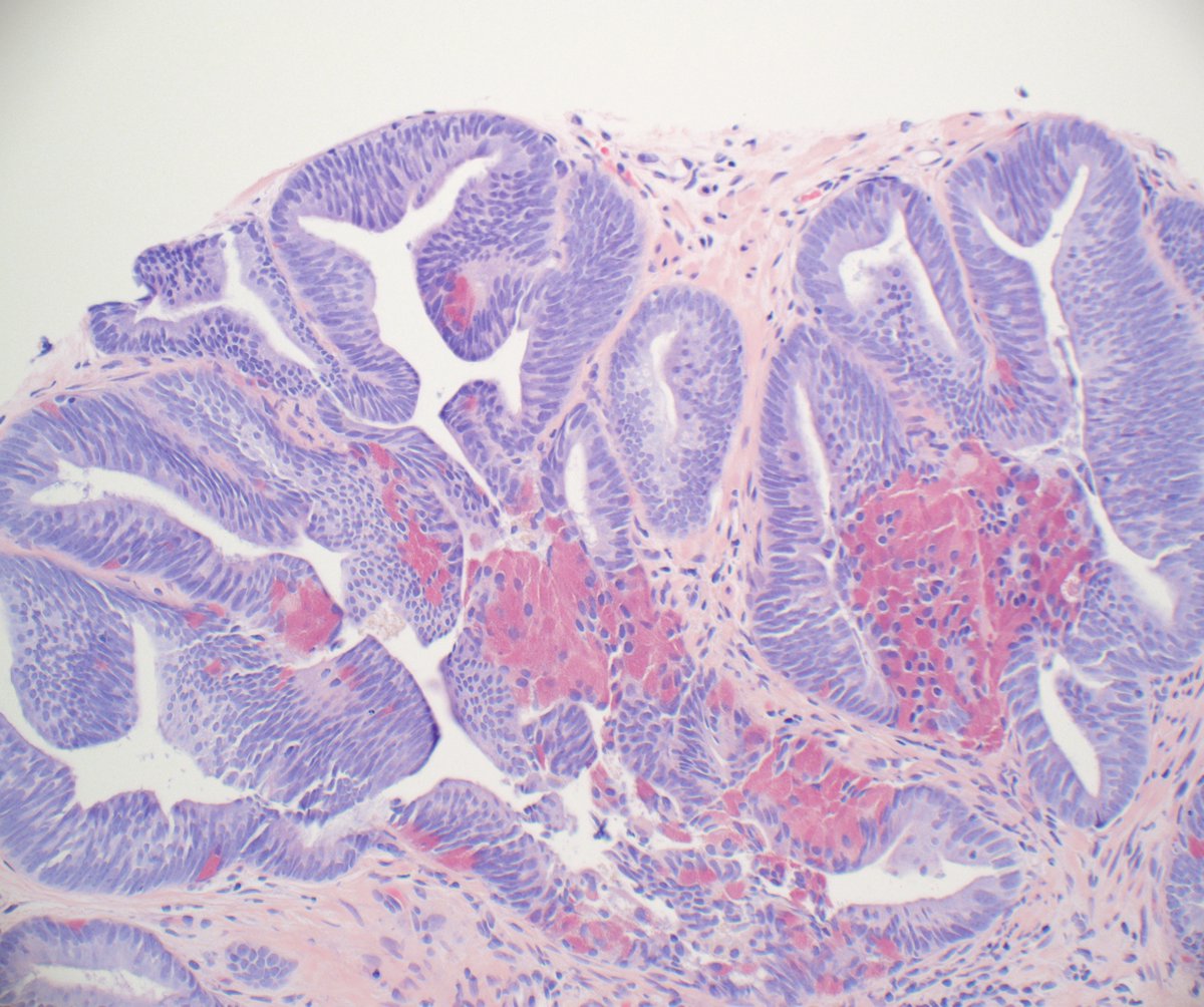 Ankur Sangoi tweet media