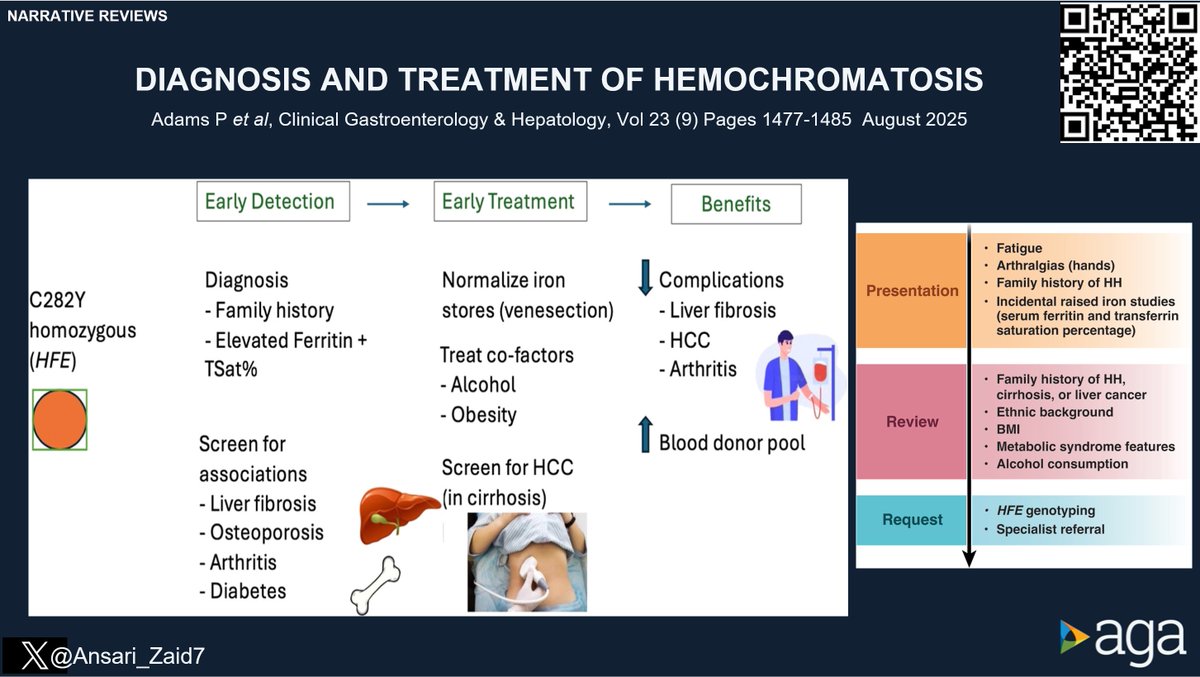 Joseph Sleiman, MD, FACP (@josephhabibi_md) on Twitter photo #CGH4ALL <a href="/AGA_CGH/">CGH</a> 📣
An elevated ferritin level is a non-specific but potentially indicative of excess iron deposition.
Refresh your memory on hemochromatosis w/ this article!
Reported by <a href="/Ansari_Zaid7/">Zaid Ansari</a>
🔗 cghjournal.org/article/S1542-…
<a href="/drtimothyli/">Timothy Li</a> <a href="/theliverdr/">TheLiverDoc</a> <a href="/ebtapper/">Elliot Tapper</a> #CGH4ALL <a href="/AGA_CGH/">CGH</a> 📣
An elevated ferritin level is a non-specific but potentially indicative of excess iron deposition.
Refresh your memory on hemochromatosis w/ this article!
Reported by <a href="/Ansari_Zaid7/">Zaid Ansari</a>
🔗 cghjournal.org/article/S1542-…
<a href="/drtimothyli/">Timothy Li</a> <a href="/theliverdr/">TheLiverDoc</a> <a href="/ebtapper/">Elliot Tapper</a>