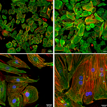 Muscle Cell News (@musclecellnews) on Twitter photo 💓 Dr. <a href="/Pratuljain10/">Pratul jain</a> and researchers at <a href="/DBT_inStem/">iBRIC-inStem</a> identified a pathogenic missense variant in tubulin tyrosine ligase in a patient with hypertrophic cardiomyopathy.
👉 <a href="/JCI_insight/">JCI insight</a> | bit.ly/4mwfLME 💓 Dr. <a href="/Pratuljain10/">Pratul jain</a> and researchers at <a href="/DBT_inStem/">iBRIC-inStem</a> identified a pathogenic missense variant in tubulin tyrosine ligase in a patient with hypertrophic cardiomyopathy.
👉 <a href="/JCI_insight/">JCI insight</a> | bit.ly/4mwfLME