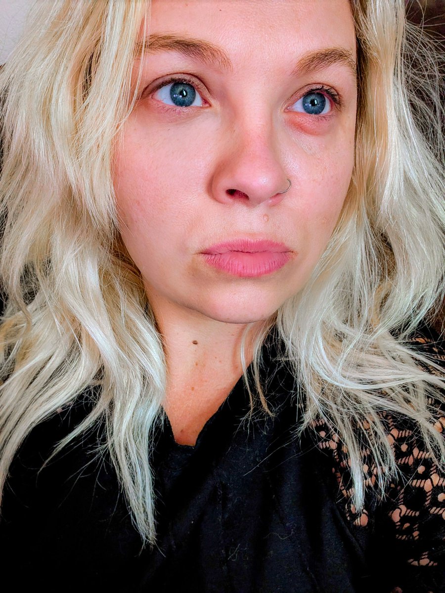 FG has eye surgery Thursday. I think I accidentally cursed myself.