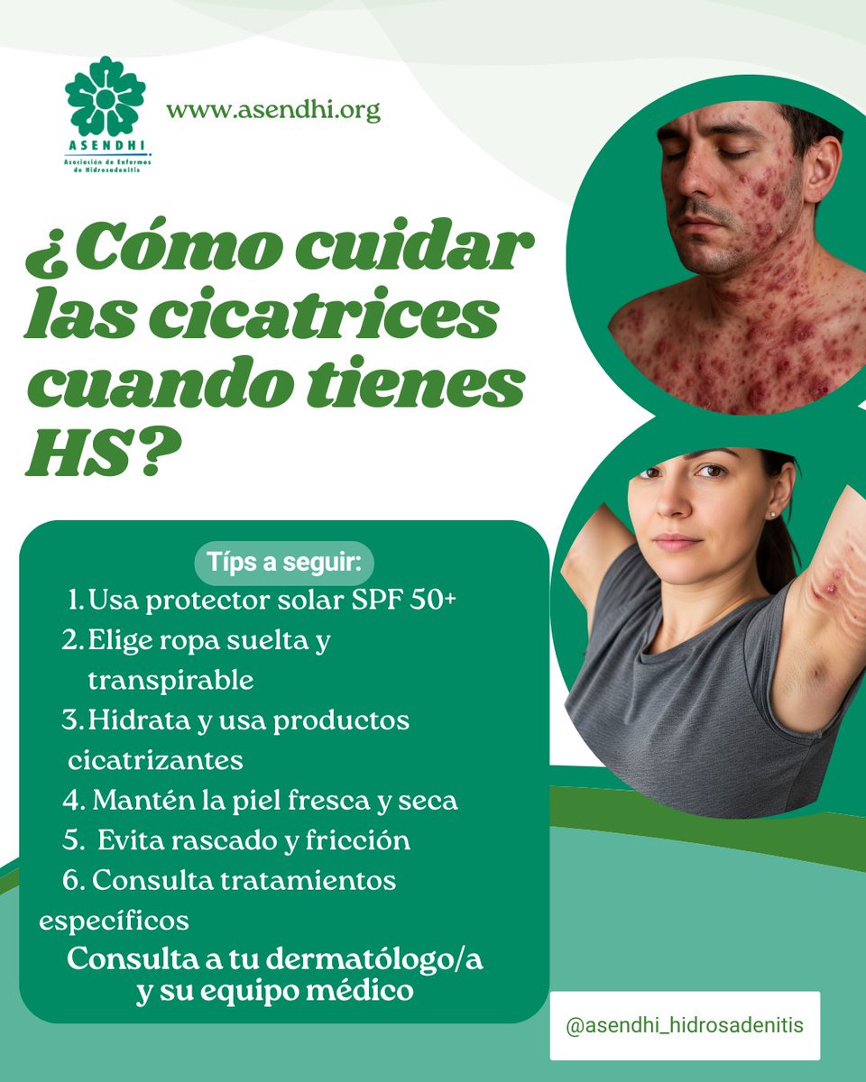 🩹¿Cómo cuidar las cicatrices cuando tienes HS?
Aquí tienes algunos consejos que pueden ayudarte:
#HidrosadenitisSupurativa #Autocuidado #CuidadoDeLaPiel #cicatrices #Bienestar #PielSaludable #ᴀᴍᴏʀᴘʀᴏᴘɪᴏ #HS #dermatologia