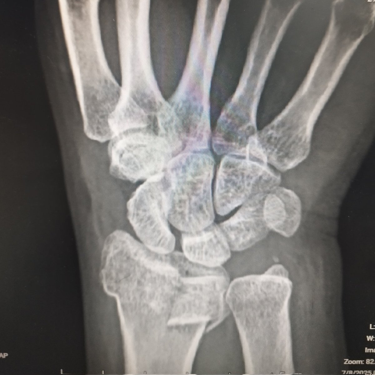 Will 🦴🛠💪🏼 tweet media