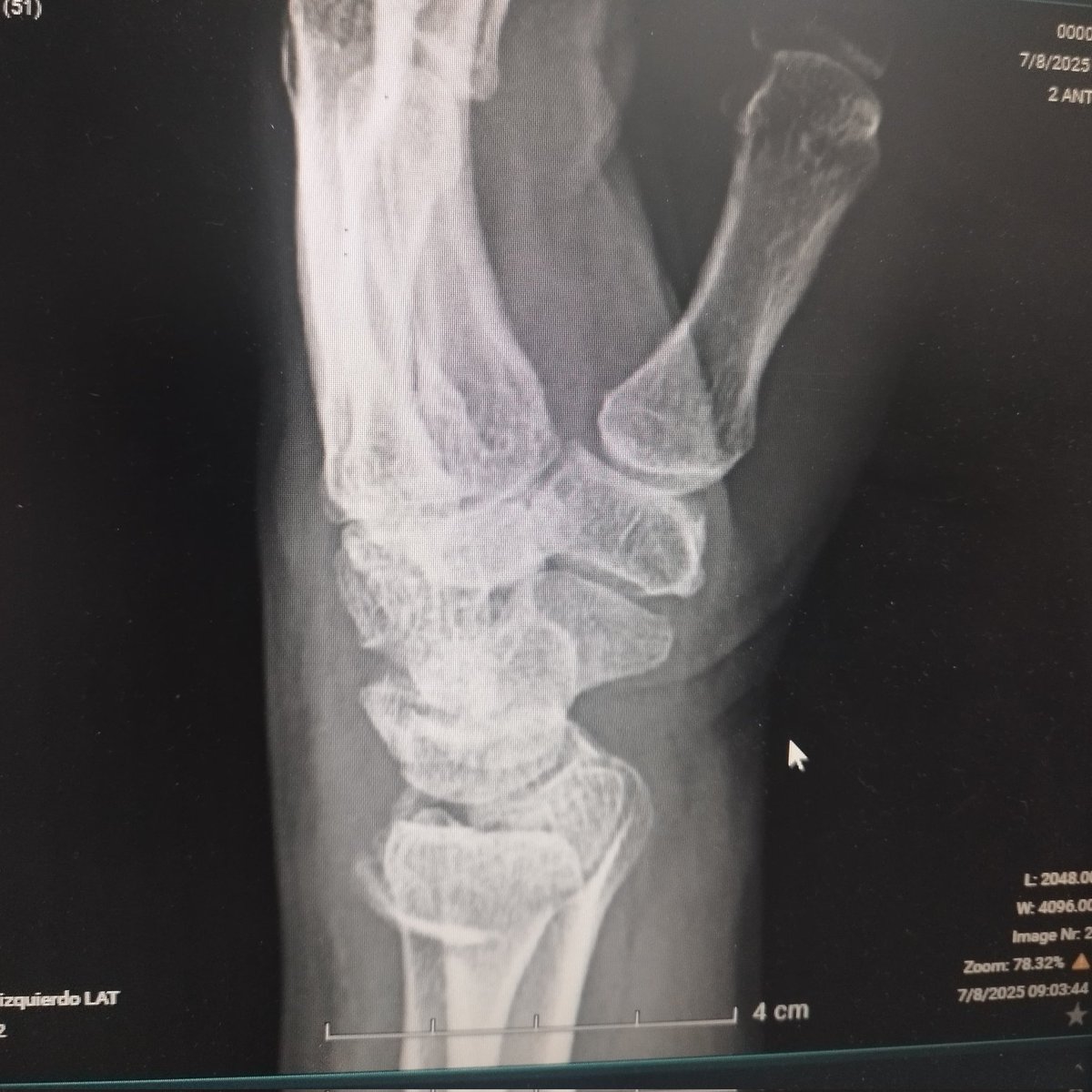 Will 🦴🛠💪🏼 tweet media