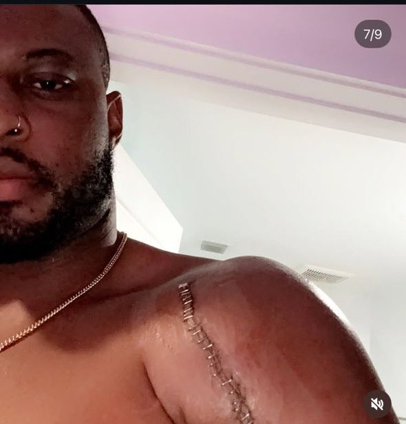 kaybronsix's tweet photo. Just a reminder, Kaybobo recently had surgery last year on his arm after an injury. 

The current task puts extra strain on his shoulder, so it’s no surprise he struggled. 

Please let’s learn to give him the grace he deserves. 

NEVER STOP VOTING KAYBOBO. ⚠️

#BBNaija #Kaybobo https://t.co/EYVUzjbBlb