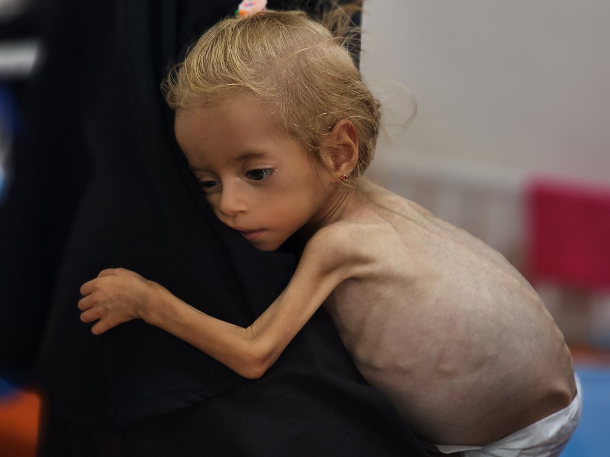 Surat kabar The Guardian mengutip pernyataan perwakilan Organisasi Kesehatan Dunia di wilayah Palestina: Lebih dari separuh obat-obatan di Gaza telah habis, situasi kesehatan secara umum sangat buruk, dan kelaparan serta kekurangan gizi terus menghancurkan Jalur Gaza.