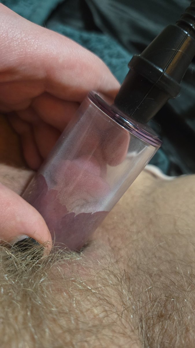 TboiZack's tweet photo. Finally got a pump!
Thank you @ftmbison for the link in his bio! It works great!

#ftm #T4T #trans #nsfwtw #pumpedclit #Tdick #largeclit #transmasc #transclit https://t.co/xY6O1xcnah