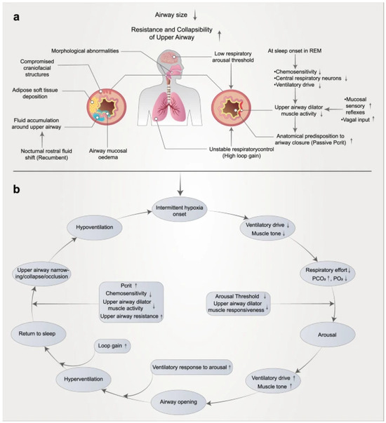 📢 Feel free to read our recent publication:

Contemporary Approaches to #ObstructiveSleep Apnea: A Review of #Orthodontic and Non-Orthodontic Interventions in Children and Adults mdpi.com/3430712 #mdpioral via <a href="/Oral_MDPI/">Oral MDPI</a> 

👨‍🔬 by Janvier Habumugish

#OSA
