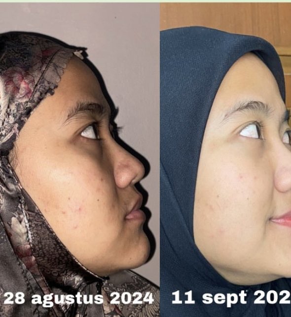 Indoganic Beauty tweet media
