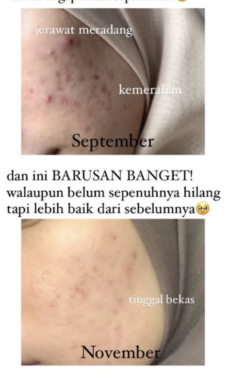 Indoganic Beauty tweet media