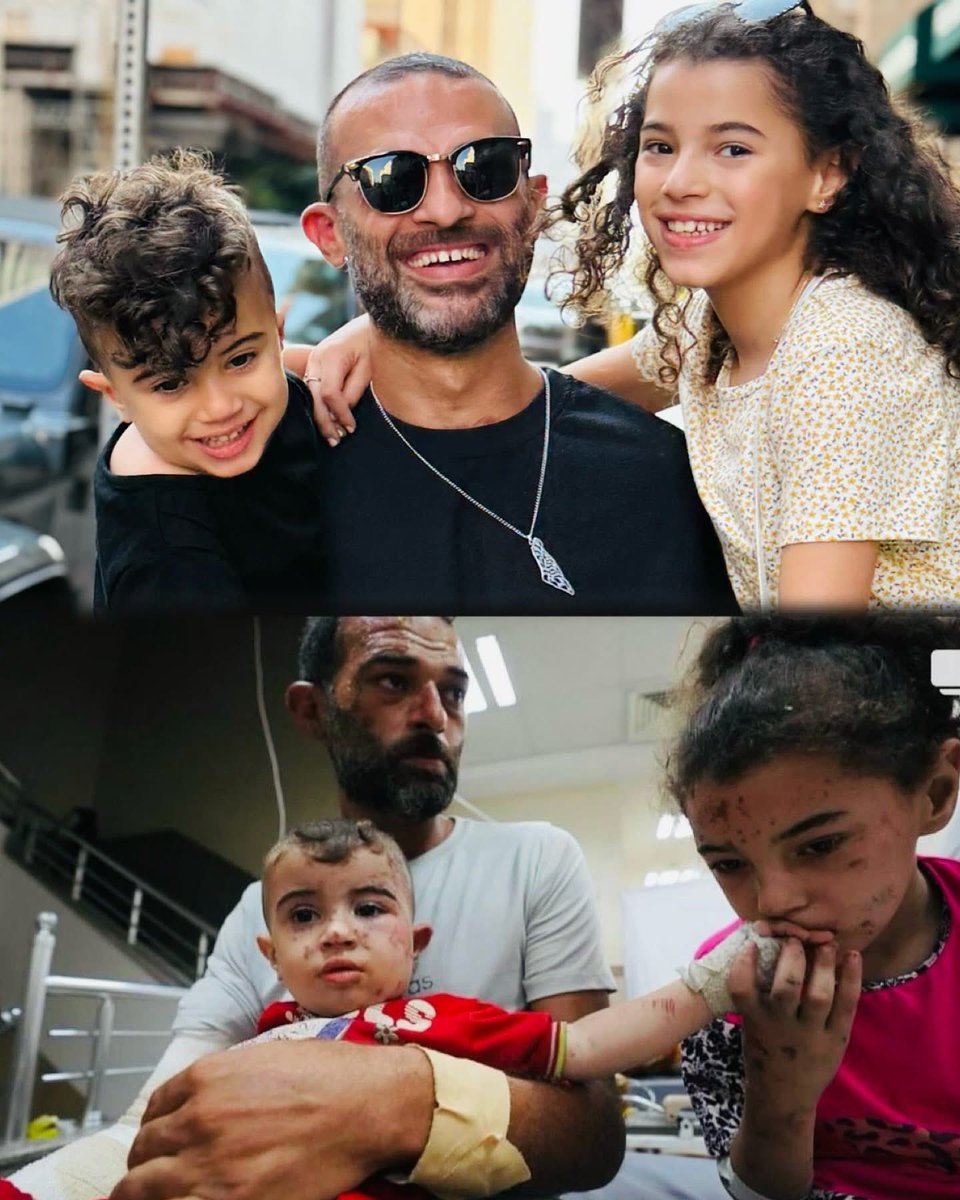 Two photos. Same father. Same children.
Both after war.

One — under hospital lights, burnt, bandaged, without their mother.
The other — in the sunlight, smiling… still without her.

They lost more than words can hold.