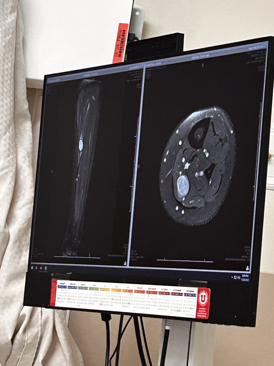 Surgery time tomorrow early in the morning, wish me luck, soon we can start deadlifting again