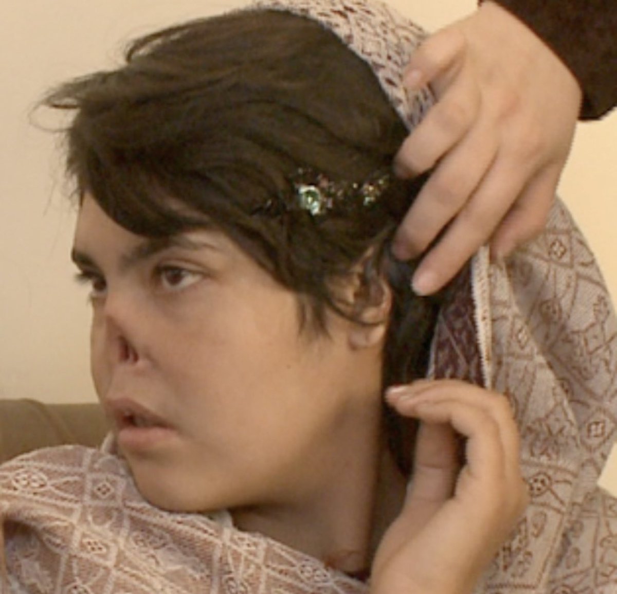 This is Sharia law in action.
Both the nose and ear were cut off.