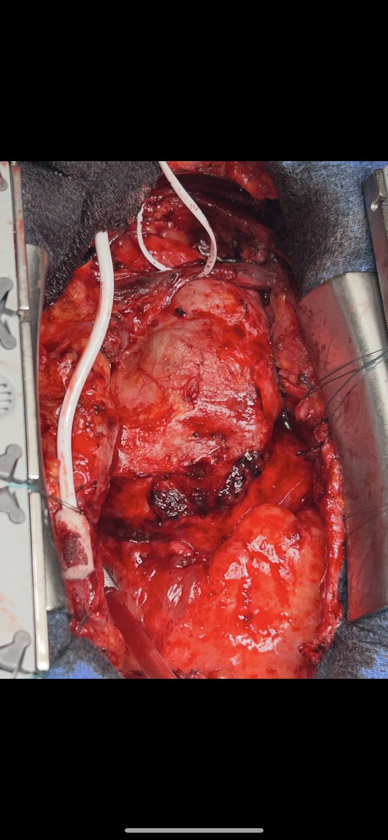 Miroslav P. Peev, MD FACS FACC tweet media