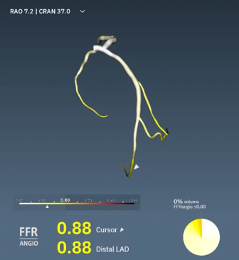 Sripal Bangalore tweet media