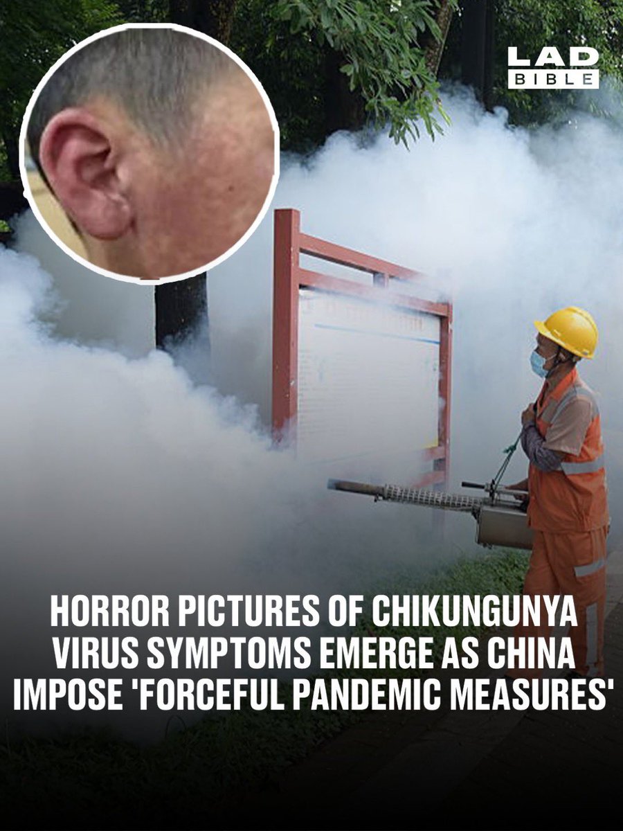 Good morning jab fans. I make no apologies for showing you this horror picture as you eat your co-co pops this morning. Its about time you knew the truth of the killer chick-pea virus. This is a genuine picture of Roy at 71 who is dealing with a full blown case of killer