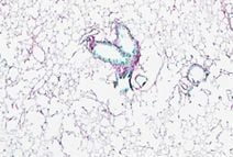 dukenus's tweet image. 65LAB is investing US$1.5M in #DukeNUS Prof Enrico Petretto’s Systems Genetics platform—combining #AI, #computational #biology & quantum computing to develop the first antifibrotic therapies for lung & #kidney #diseases. Read more: duke-nus.edu.sg/newshub/media-…
📸: Chen Huimei