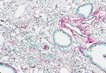 dukenus's tweet image. 65LAB is investing US$1.5M in #DukeNUS Prof Enrico Petretto’s Systems Genetics platform—combining #AI, #computational #biology & quantum computing to develop the first antifibrotic therapies for lung & #kidney #diseases. Read more: duke-nus.edu.sg/newshub/media-…
📸: Chen Huimei