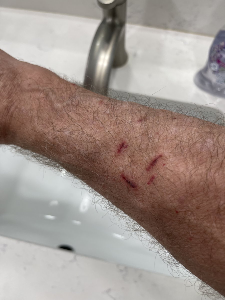 SubduedSnarl's tweet photo. Little Furrari's handiwork done
w/ her teeth, while high on Gabapentin
but not ENOUGH Gabapentin !😴

#Kittens #Spayed #Cats 
#BiteMarks https://t.co/yopY2AKCkZ