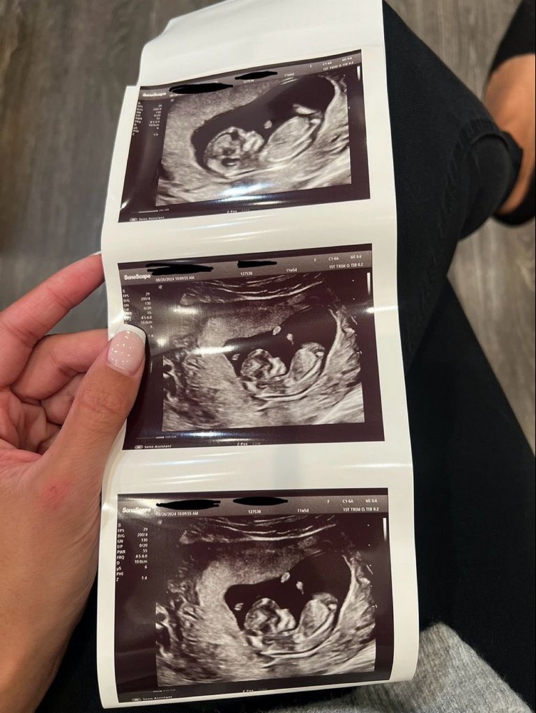 junjissi's tweet photo. baby evol due march 20th i can tell they're hyun biased 🥺❤️ https://t.co/liQSHKPvhX