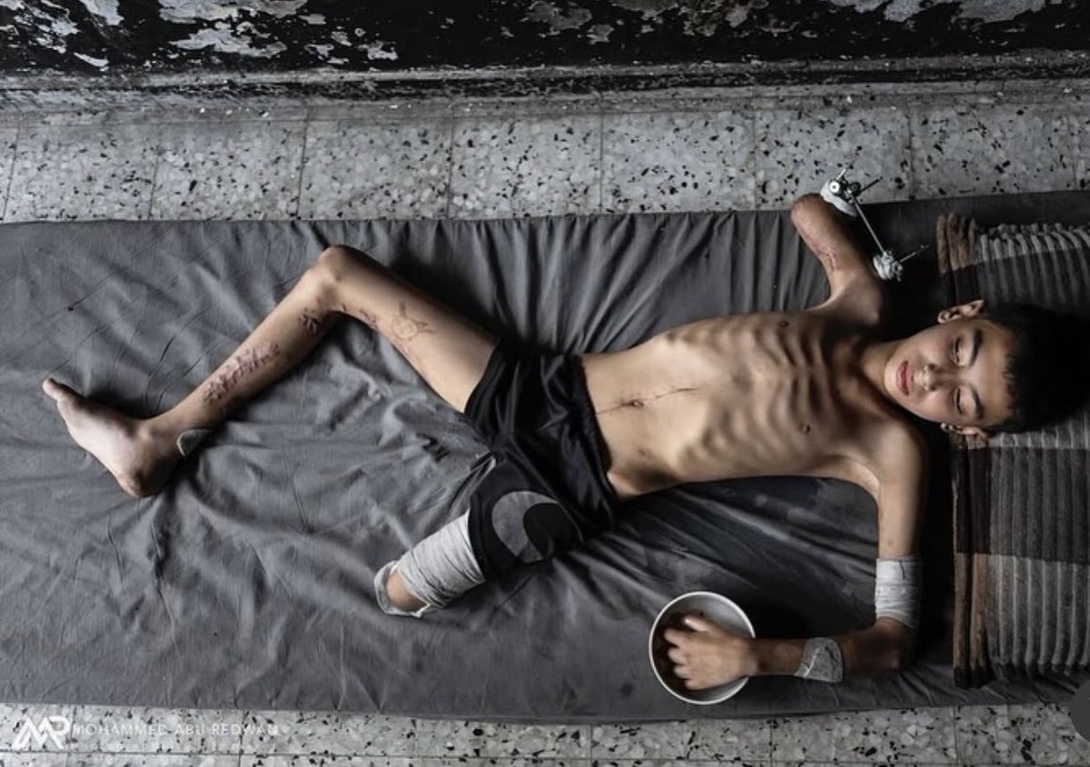#GazaGenocide‌ 
13.08.2025