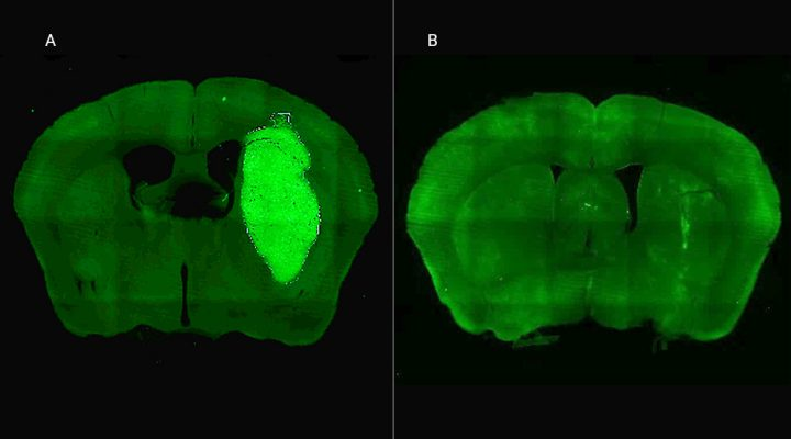 🧠Especialistas del CONICET logran frenar un tipo de cáncer cerebral en estudios preclínicos con una novedosa estrategia terapéutica.

📞Hablamos con Marianela Candolfi, investigadora del CONICET que lidera el laboratorio de Inmunoterapia Antitumoral.

#CiudadInvisible🏙️