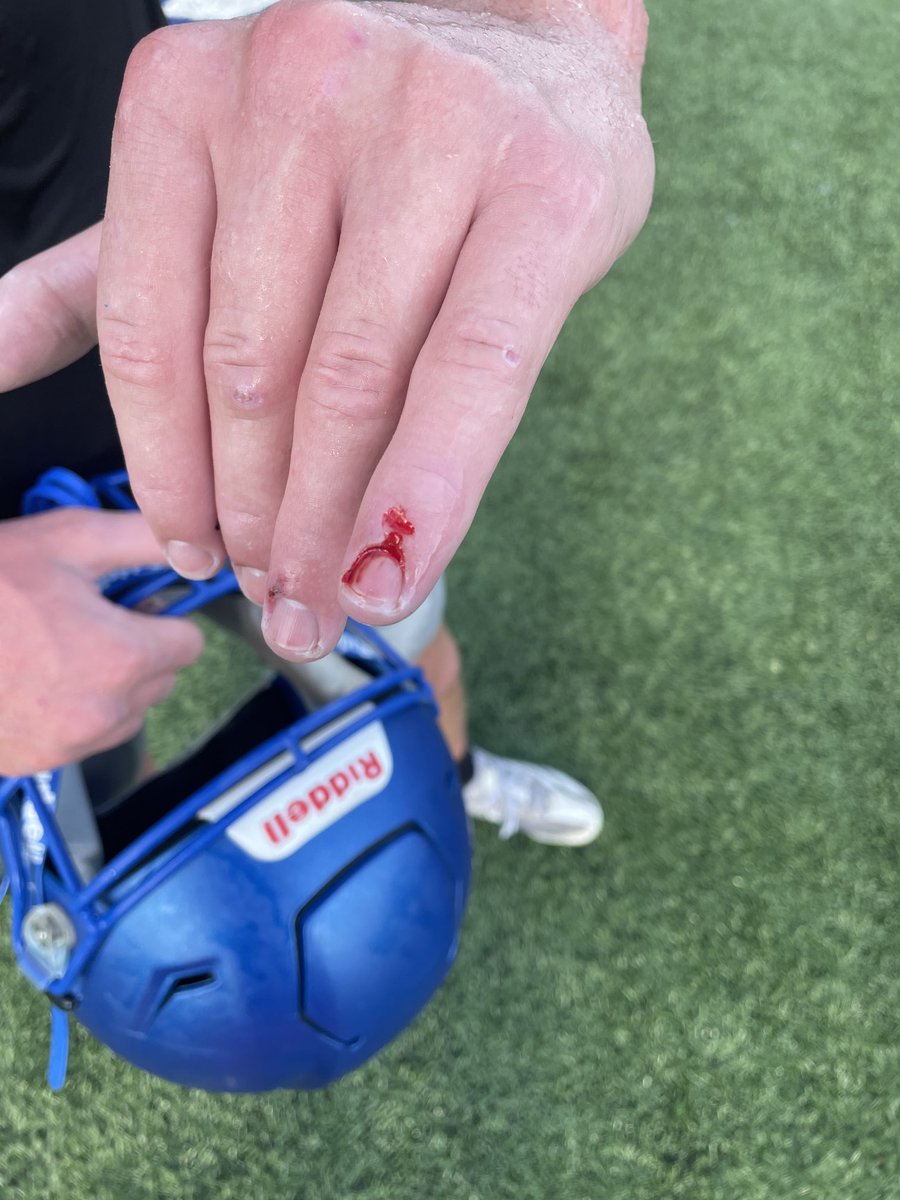 Bloody Wednesday…..I’ll take it!!