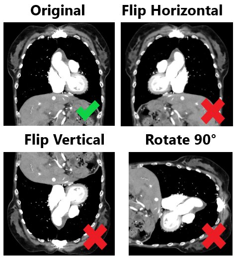 MLHealthScience's tweet image. 🔬 Augment wisely.
$MLHS Playground can expand datasets (noise, contrast, tiny jitter) to boost generalization, but anatomy has rules. For single-organ or orientation-specific tasks, don’t use left↔right flips, vertical flips, or 90° rotations
#MedAI #DataAugmentation #Radiology