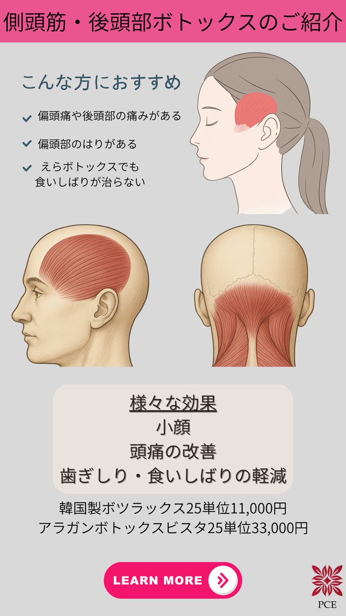 側 頭 筋 ボトックス