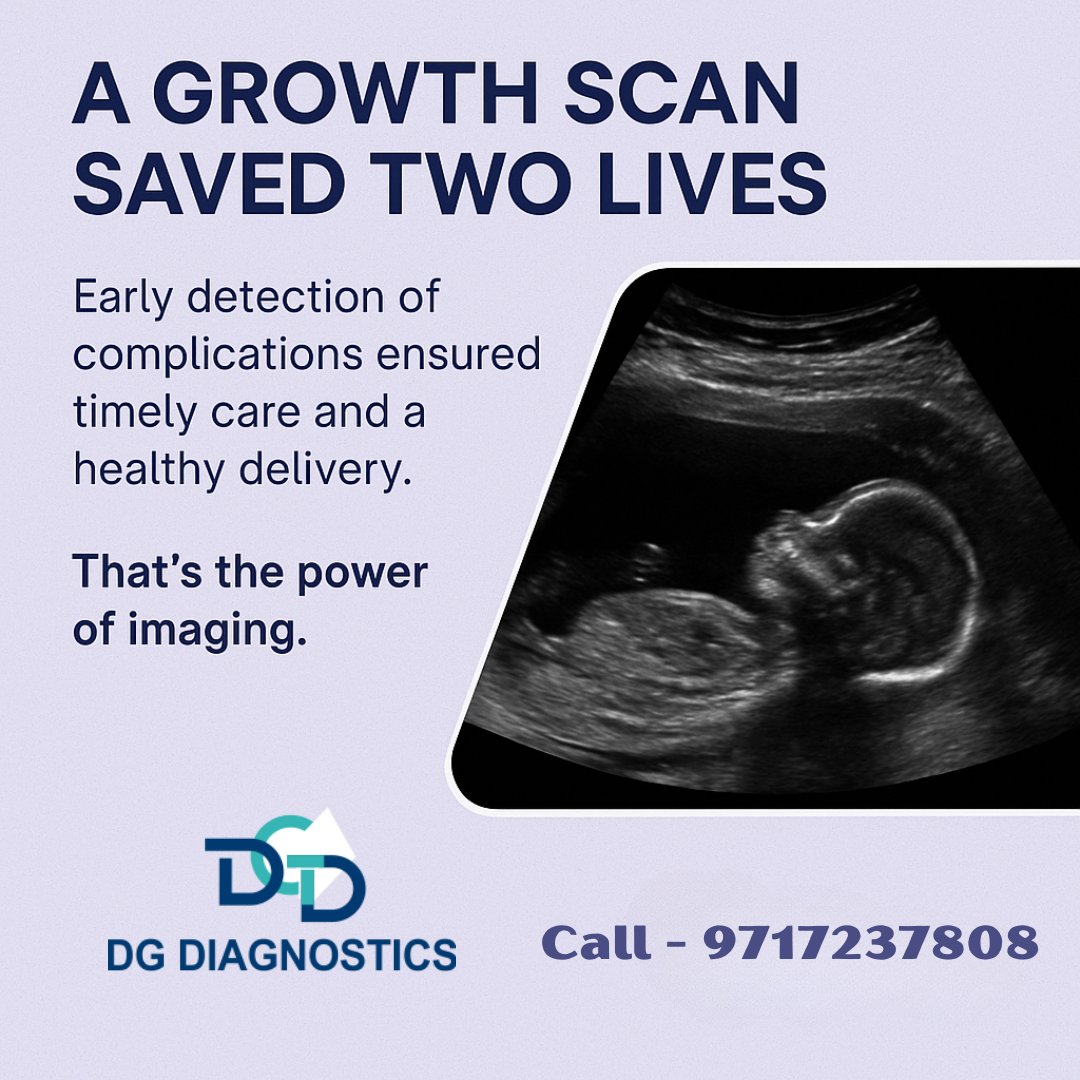 dgdiagnostics's tweet image. A Growth Scan Saved Two Lives
Early detection isn’t just important – it’s life-changing.
During a routine growth scan, we identified complications that could have risked both mother and baby.
#GrowthScan #PregnancyCare #DGDiagnostics #SafeDelivery #UltrasoundCare #PowerOfImaging