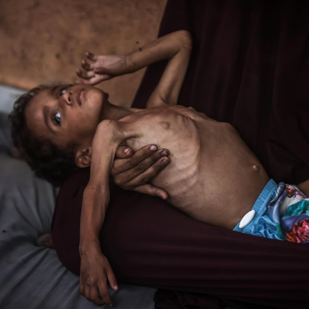 Gazze'de çocuklar açlıktan ölüyor