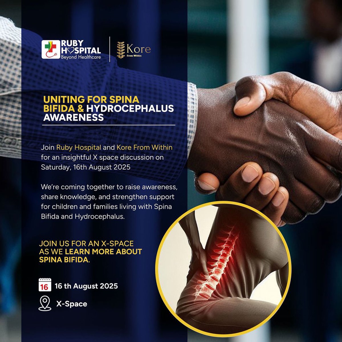 Health equity means leaving no one behind.
This Saturday, from 7pm to 8:15pm, Ruby Hospital and Kore From Within are joining forces to shine a light on Spina Bifida &amp; Hydrocephalus. 

Together we’ll raise awareness, share knowledge and strengthen support for children and families