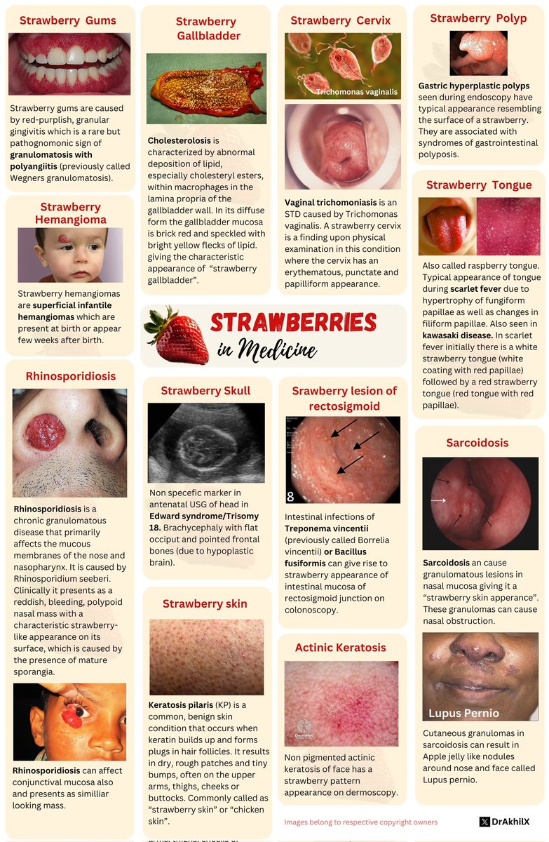 docakx's tweet photo. 🍓Strawberries in medicine https://t.co/HVepK0rCOv