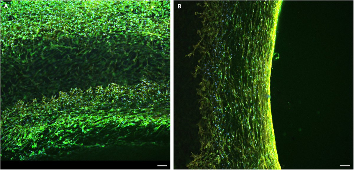 SPJournals's tweet image. JUST PUBLISHED: Tissue Engineering In Vitro Leaflet- and 3-Dimensional Printing-Based Implant Prototypes for Infant Mitral Valve

Click here to read the latest free, Open Access article from BMEF: spj.science.org/doi/10.34133/b…

#tissueengineering #pediatrics #bioengineering