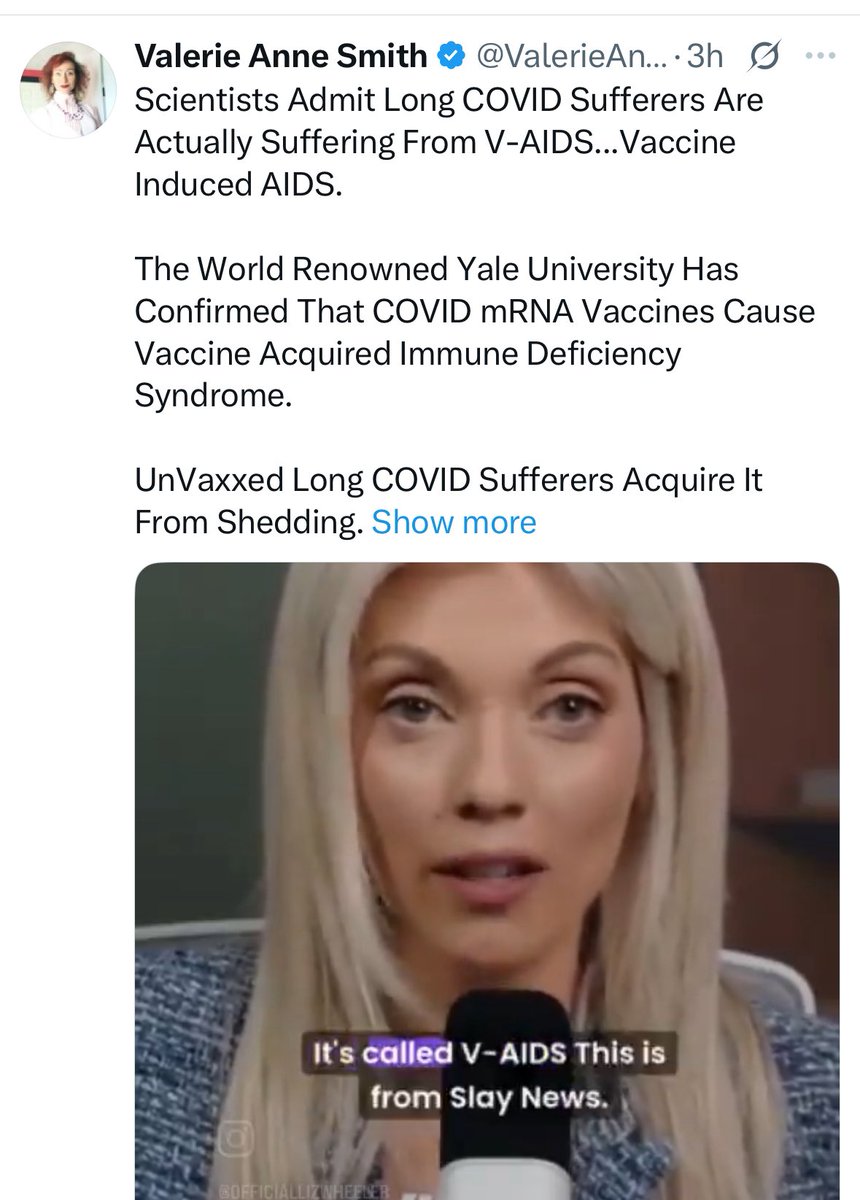 No 

No there is no such thing as vaccine induced AIDS. V-AIDS 

Don't be so utterly ridiculous