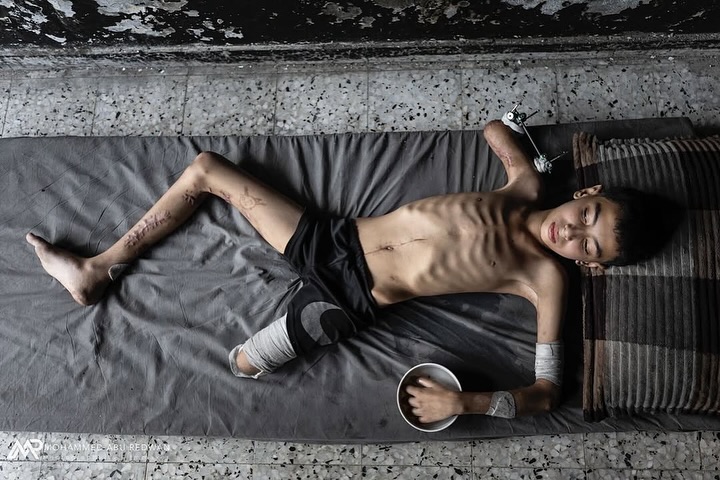 11 yaşındaki Gazzeli çocuk Samir 💔