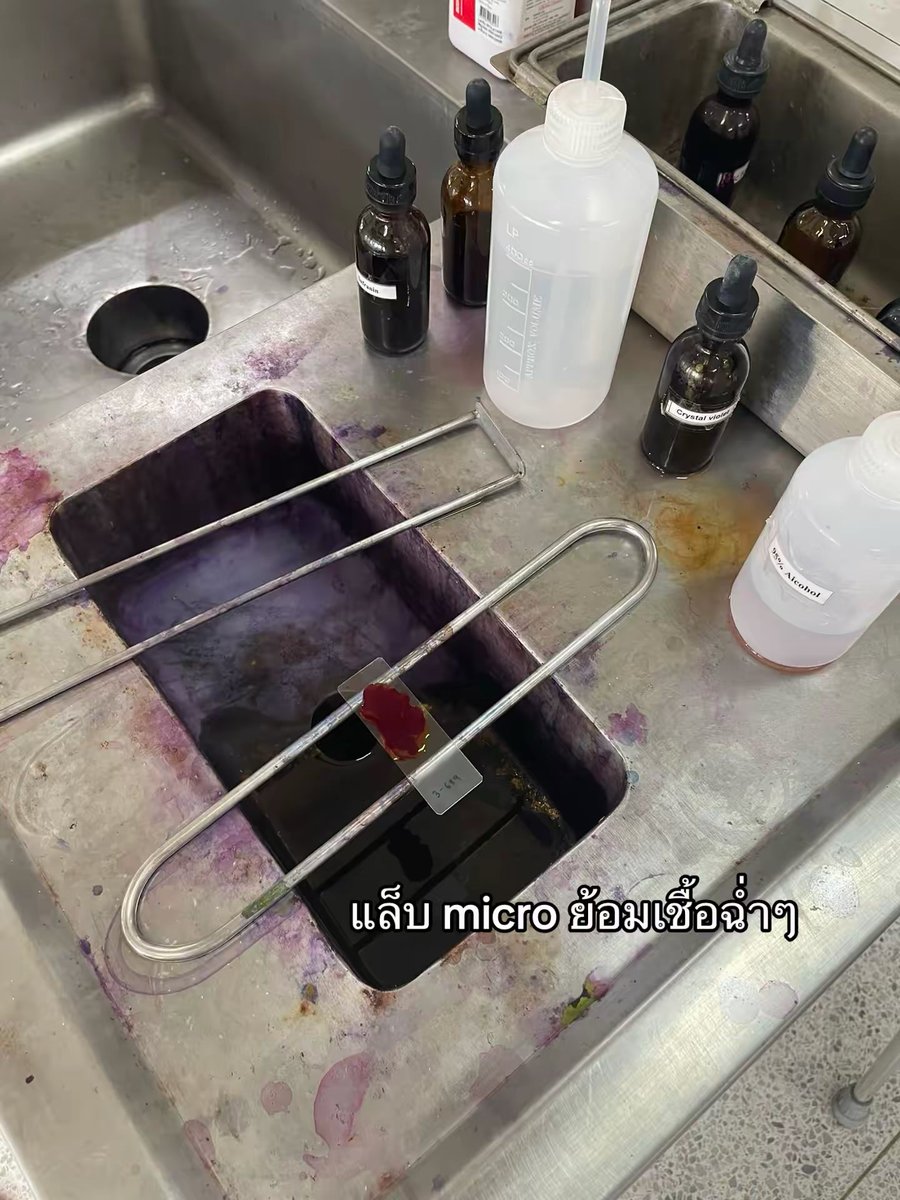 documed1ary's tweet image. RS recap | บล็อคที่นศพ.ครึ่งรุ่นพลิกโอกาสเป็นวิกฤติ

เป็นบล็อคที่ใช้เวลาคุ้มมากๆ อาจารย์ให้เวลาหยุดอ่านหนังสือมาเยอะ แต่เราก็เอาไปทำกิจกรรมหมดเลย พลิกโอกาสเป็นวิกฤติสุดๆ

#mymdkkud1ary #medstudentlife  #studygram #นศพ #แพทย์มข