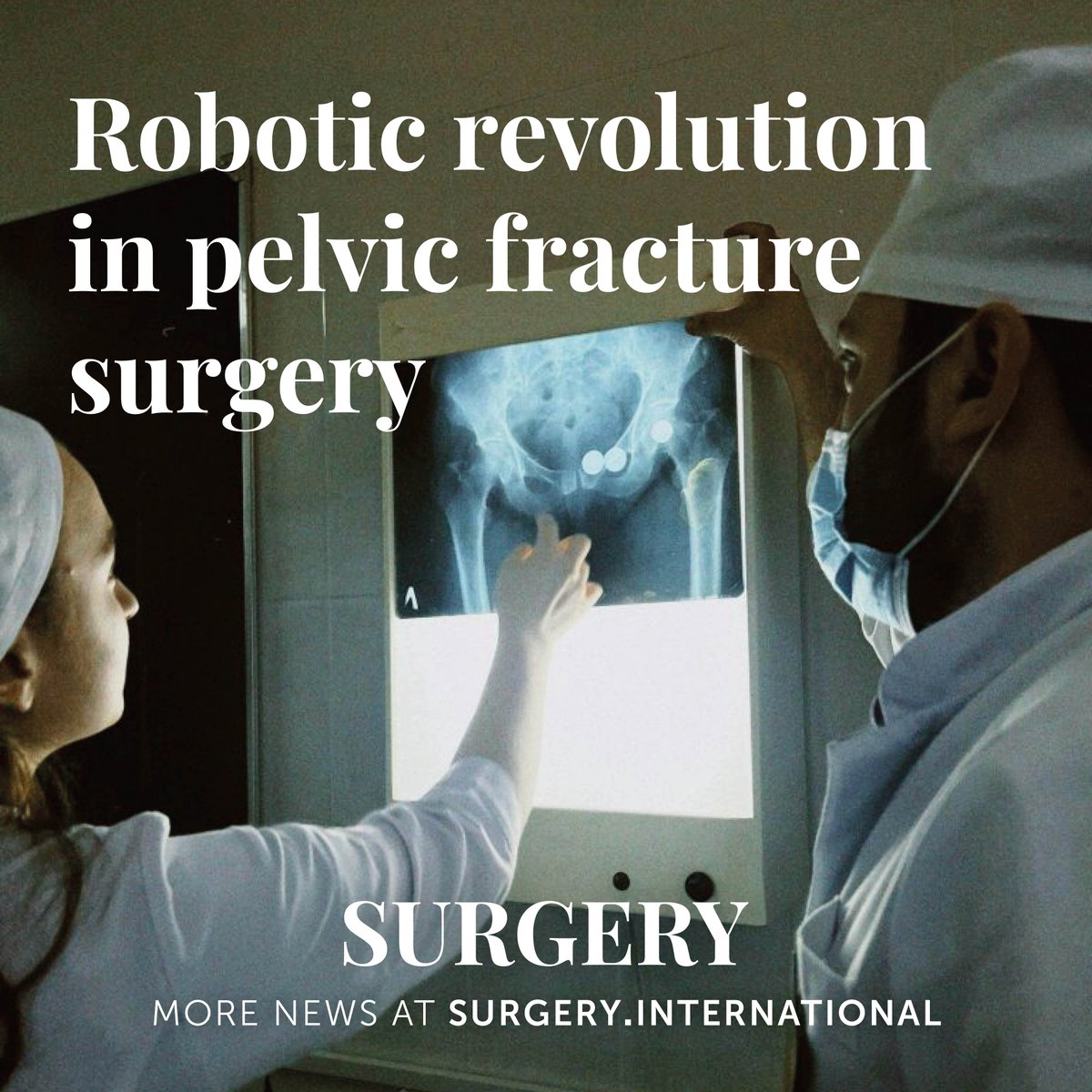 New study shows robot-assisted surgery for unstable pelvic fractures boosts precision, safety &amp; patient outcomes. Rossum Robot + TiRobot = smarter, standardized care. #MedTech #Surgery #Innovation