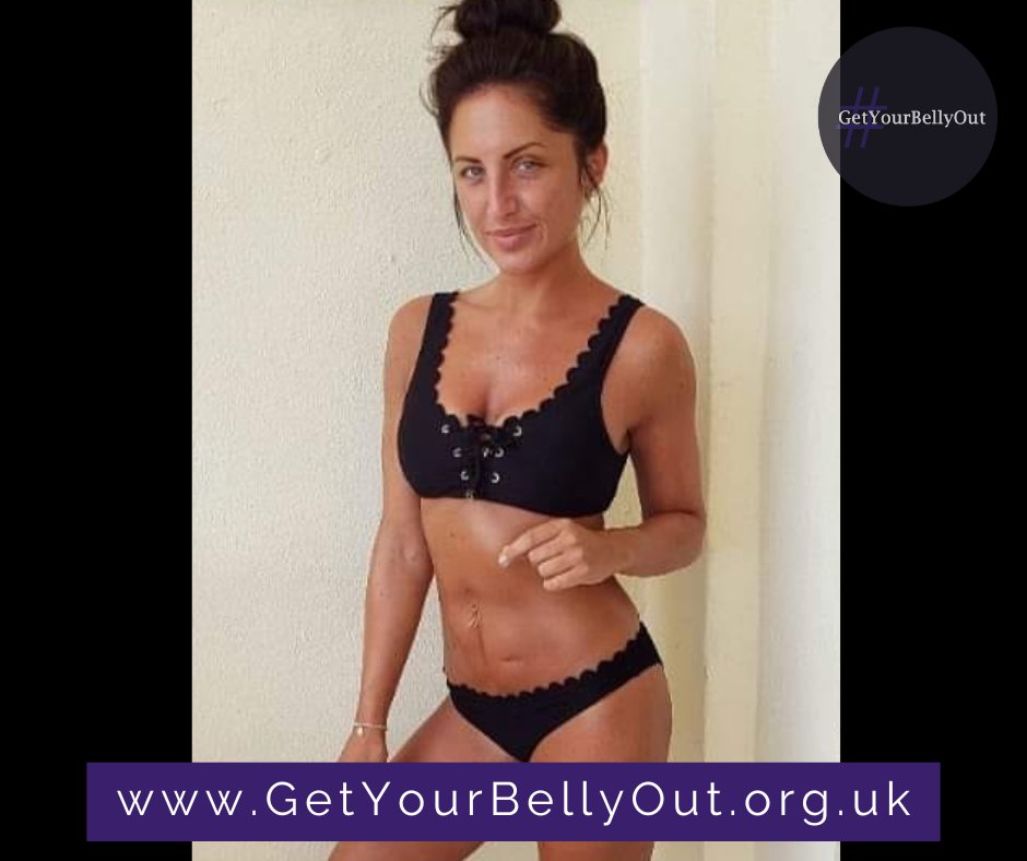 GetYourBellyOut's tweet image. "Proudly showing my scars on holiday in Mallorca &amp;amp; having the BEST time ☀️🍻"

😍 Rachel, we're loving your confidence! If you #GetYourBellyOut, be sure to send us your gorgeous photos as we're keen to raise awareness of Crohn's / Colitis / IBD!!
_____
*Details listed above may
