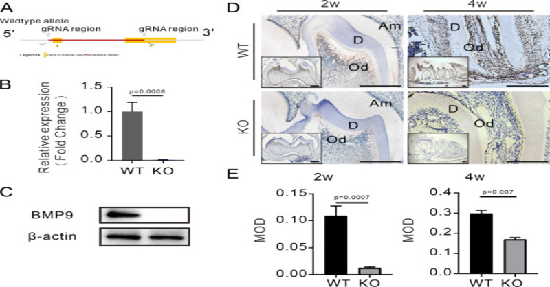 GenesNDiseases's tweet image. Using a mouse molar model, this study provides mechanistic insights into how #Bmp9 modulates #odontoblast differentiation, cell proliferation &amp;amp; intercellular junctions within the HERS during tooth root development. #Dentin @CQU1929
#OpenAccess: sciencedirect.com/science/articl…