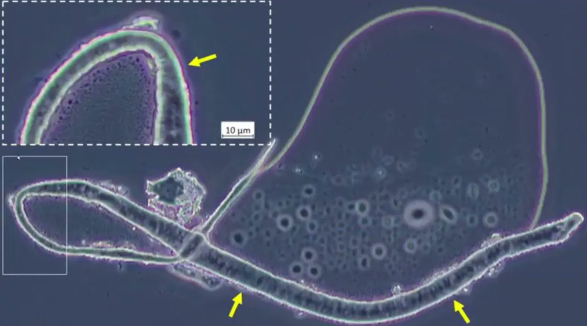 EBallzz's tweet photo. have @RealAlexJones @OwenShroyer1776 @HarrisonHSmith covered this?

Moderna's 2020 "mmRNA" patent - self-assembling #nanotubes, hydrogels, quantum dots, metallic nanoparticles, and more... 

--> https://t.co/Nd0wFWksYE https://t.co/uj0Gdhbp5q