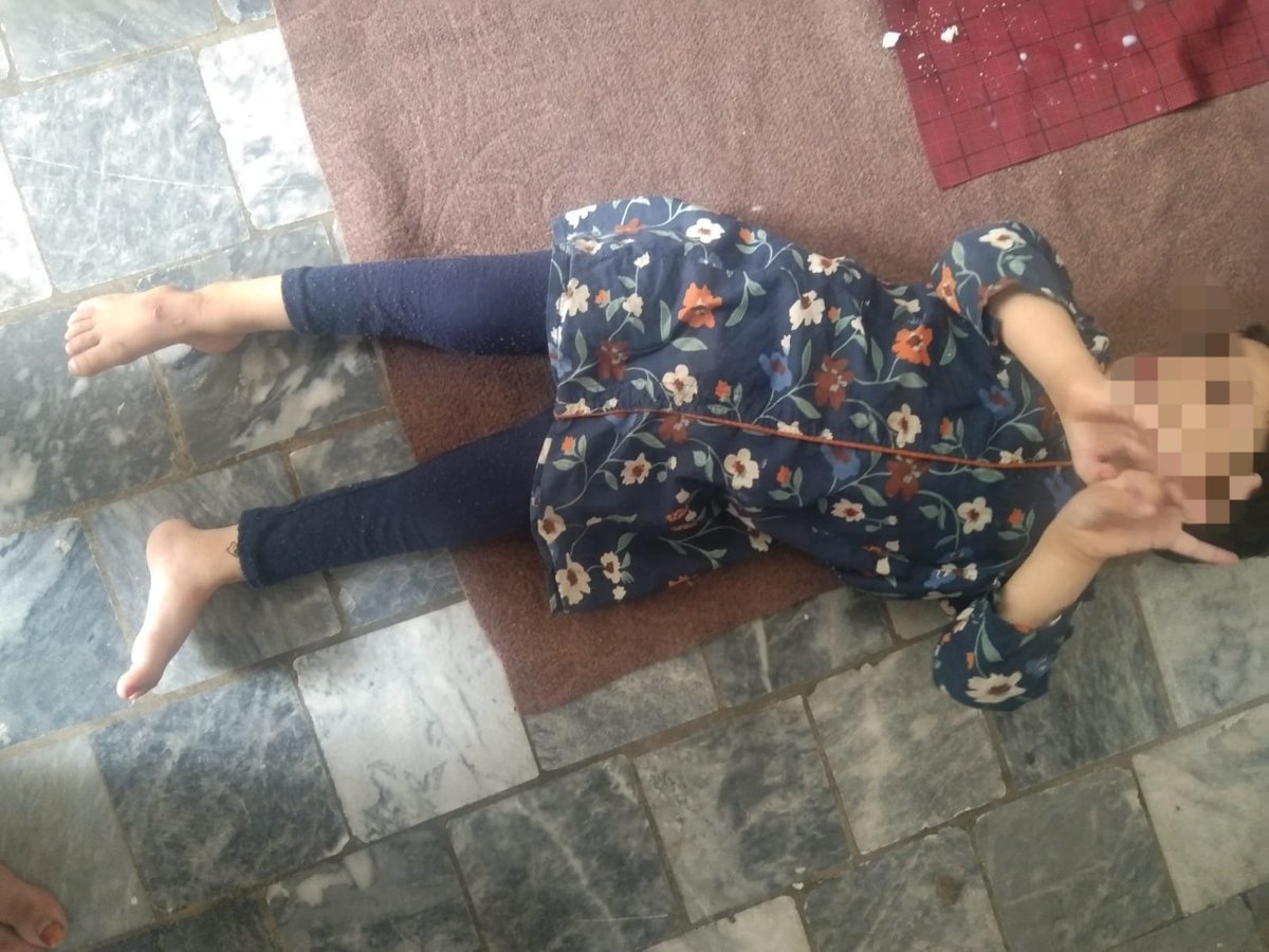 Urgent Case!!

She Can’t Walk – But You Can Help Her Move

This little girl can’t walk. Her family carries her everywhere — to the doctor, outside, even around the house. A wheelchair would give her freedom &amp; ease her family’s burden.

One gift from you can change her whole life.