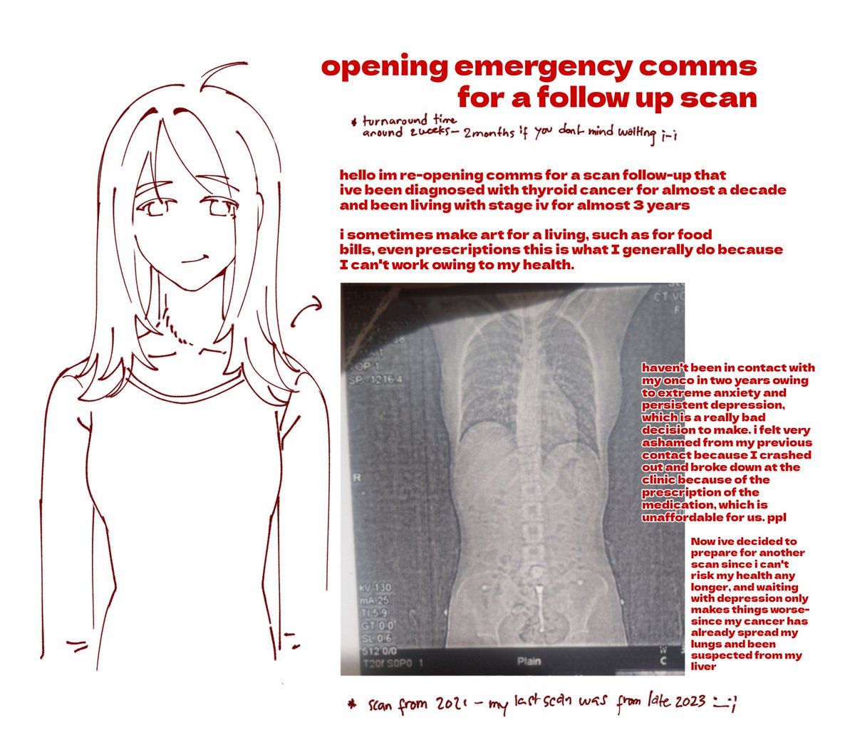 gloominny's tweet photo. comms for follow up CT scan

haha I haven't been following treatment for 2 years (don't be like me I have stage 4 cancer)

https://t.co/Zb2mDzzSwR https://t.co/eLwgt3moFv