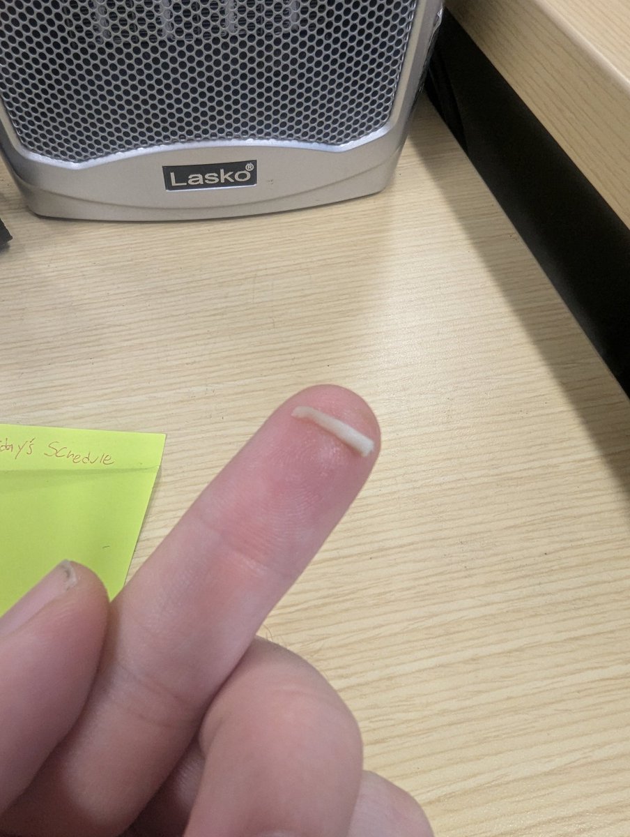 shadow12513's tweet photo. @ChipotleTweets thanks for cross contaminating cheese in the guacamole I ordered. I have a medical procedure where I can't have dairy for 6 weeks and your website claims the guac has no dairy in it. Now I have to reschedule my appointment. https://t.co/PgRmIfbA96