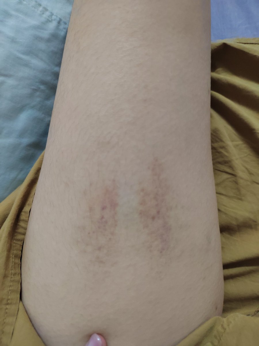 <a href="/b1ackskyyy/">theSkyyy</a> 还得是你 #小圈 #男主女贝 #大腿 #sp #实践