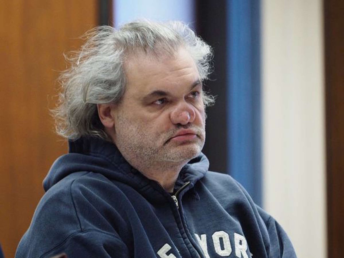 This is Artie Lange, one of the men laughing at the woman in the now re-surfaced Howard Stern video where they mock a pretty woman without makeup for being a “butterface.” “Live by the sword, die by the sword,” Artie’s nose collapsed in from snorting broken glass accidentally on